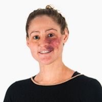 Hillary Vipond